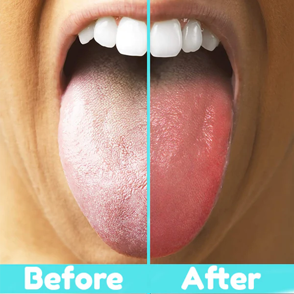ORAL MAX - Tongue Cleaner - Image 6